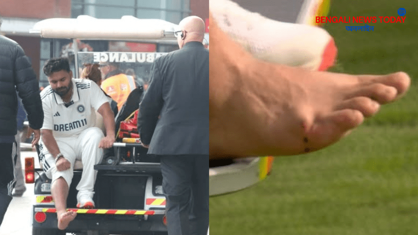 Leg injury